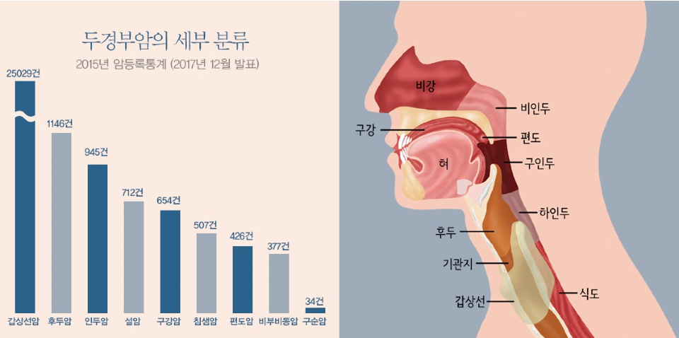 Statistics by type of head and neck cancer and anatomical structure of the head and neck region [이미지 출처 = 분당서울대병원]