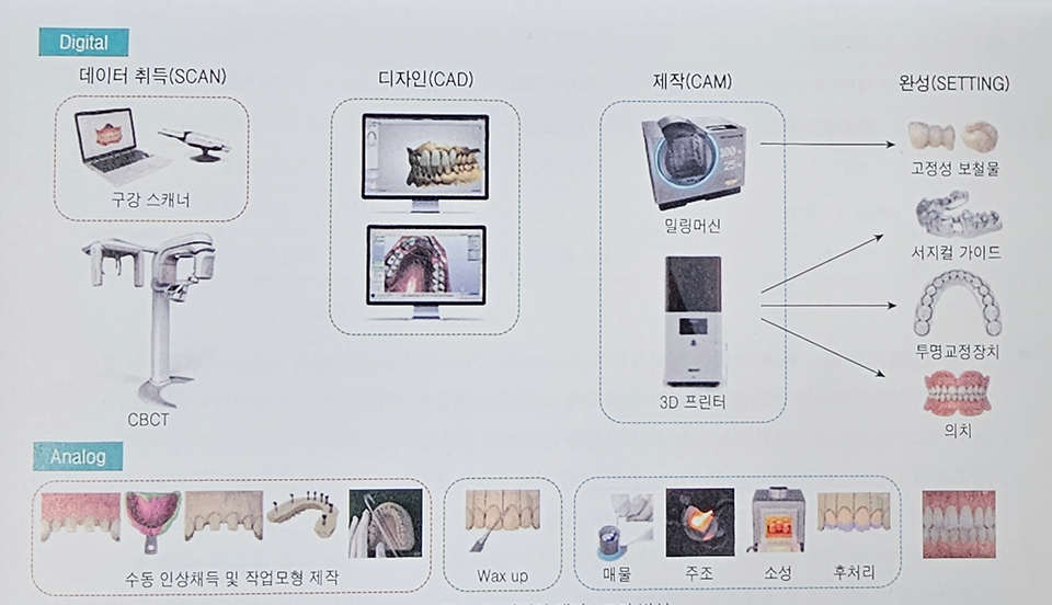 디지털과 아날로그 방식의 비교 [이미지 출처 = 『디지털 덴티스트리-기초부터 임상활용까지 완벽 가이드』(김석범, 김예성 외 3명, 대한나래출판사) p.55]