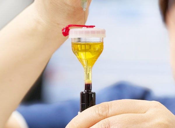 PRP 주사는 외부물질이 아닌 본인의 혈액 성분으로 치료가 이뤄지기 때문에 알레르기나 부작용이 거의 없고, 기존의 연골 주사치료보다 2~3배 빠르게 기능 회복을 돕고 염증 치유능력 또한 3~5배 정도 높다. [사진제공 = 다병원]