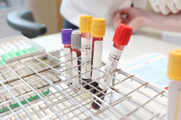  혈액 한 방울에는 우리가 먹은 음식, 겪은 스트레스, 살아온 환경의 흔적이 스며들어 있다. MDS는 이런 작은 신호들까지 놓치지 않고 분석해 우리 몸의 현재 상태를 정확히 진단한다. [사진제공 = 사과나무의료재단]