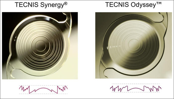  왼쪽 기존 렌즈(존슨앤존슨 시너지)와 오른쪽은 신규 렌즈(존슨앤존슨 오디세이). 사진에서도 표면이 더 매끄러워지면서 빛번짐이 많이 감소하고 대비감도가 좋아짐을 알 수 있다.